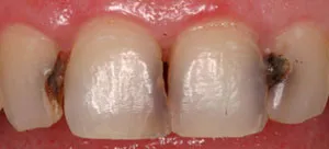 photo of teeth