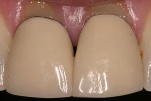 photo of teeth