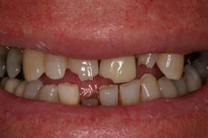 photo of teeth
