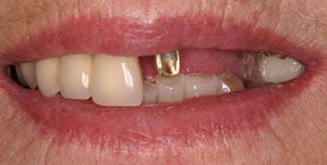 photo of teeth