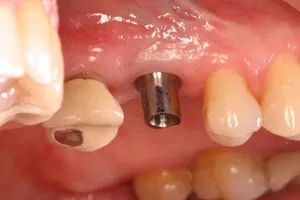photo of teeth