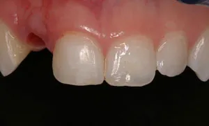photo of teeth