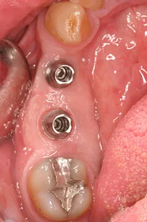 photo of teeth